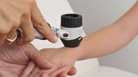 Untersuchung der Haut auf Hautkrebs